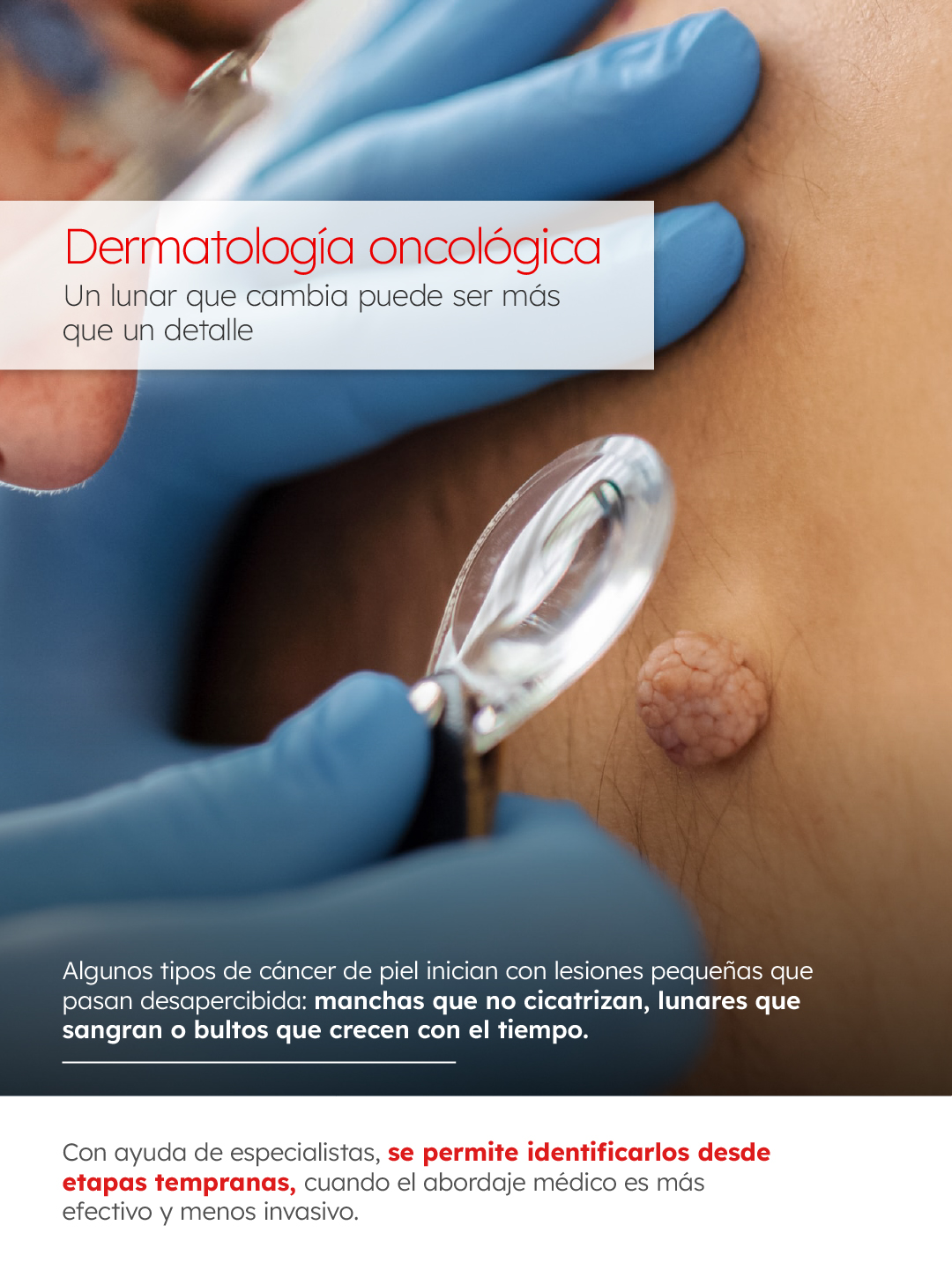 La piel también habla de tu salud. Infórmate con nosotros.
Acércate y recibe orientación especializada para tu cuidado;
📞 Contáctanos llamando a 333 642 2939 o también 333 641 5081
📱 O mediante WhatsApp: wa.me/+3338086574
📍 Encuéntranos en Olmecas 847 Col. Monraz, CP 44670: maps.app.goo.gl/L8RRupBwXAvyU5ZDA